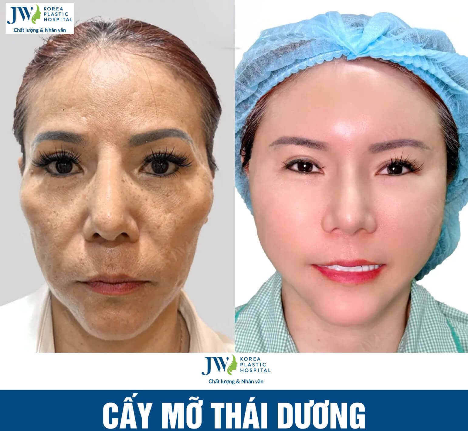 uu-diem-cay-thai-duong