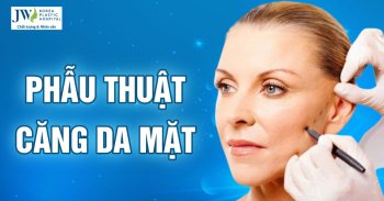 phẫu thuật căng da mặt