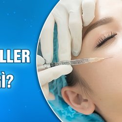 Tiêm Filler là gì? Công dụng và ưu nhược điểm thế nào?