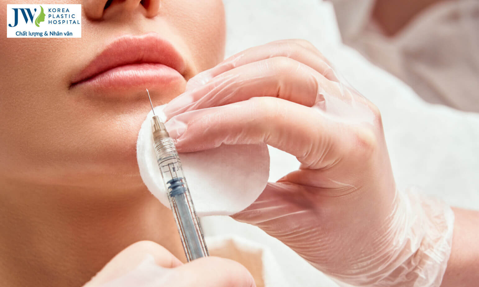 filler-giu-trong-bao-lau