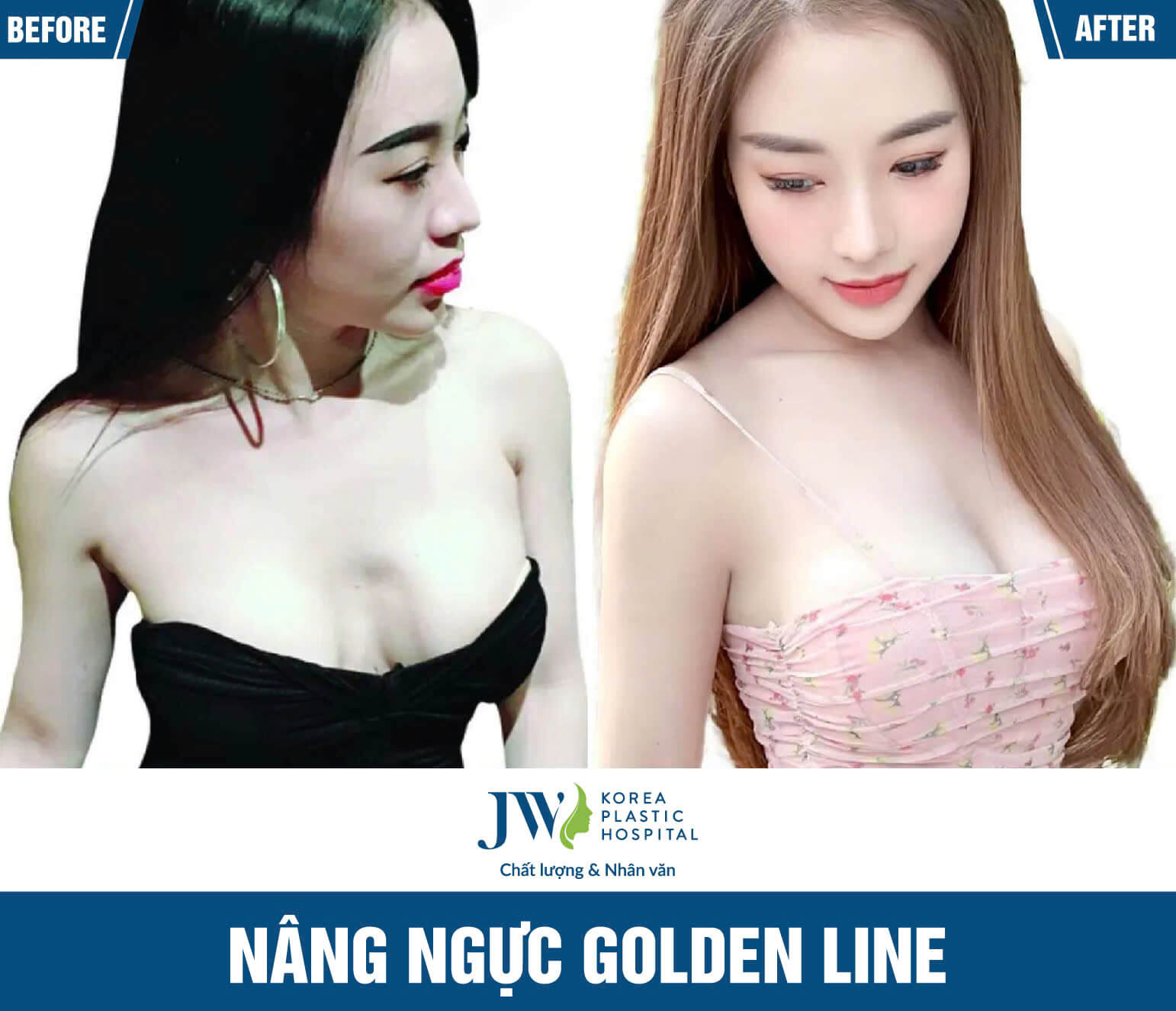 nang-nguc-jw