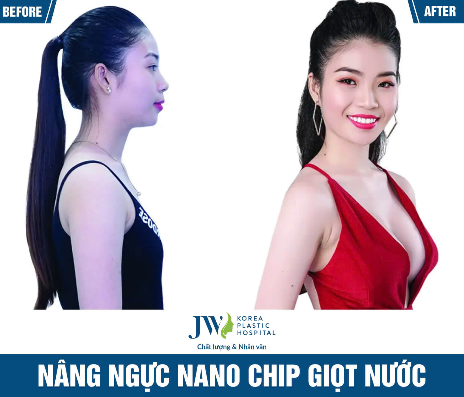 nang-nguc-nano-chip