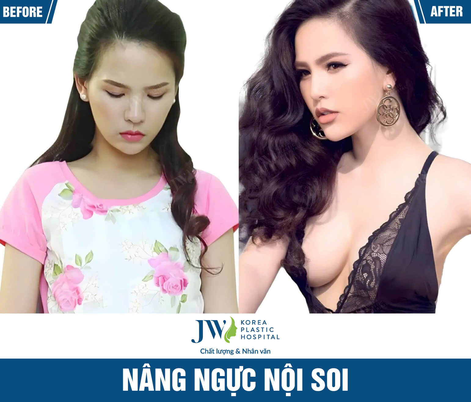 nang-nguc-noi-soi