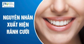 Rãnh Cười: Nguyên Nhân và Cách Xóa Nếp Nhăn, Trẻ Hóa Gương Mặt