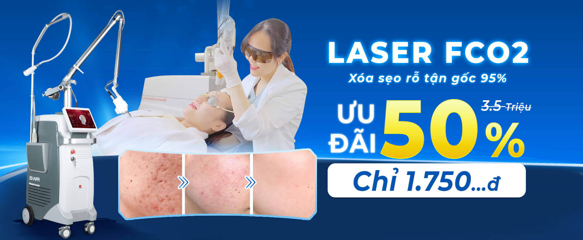 LDP Laser Sẹo