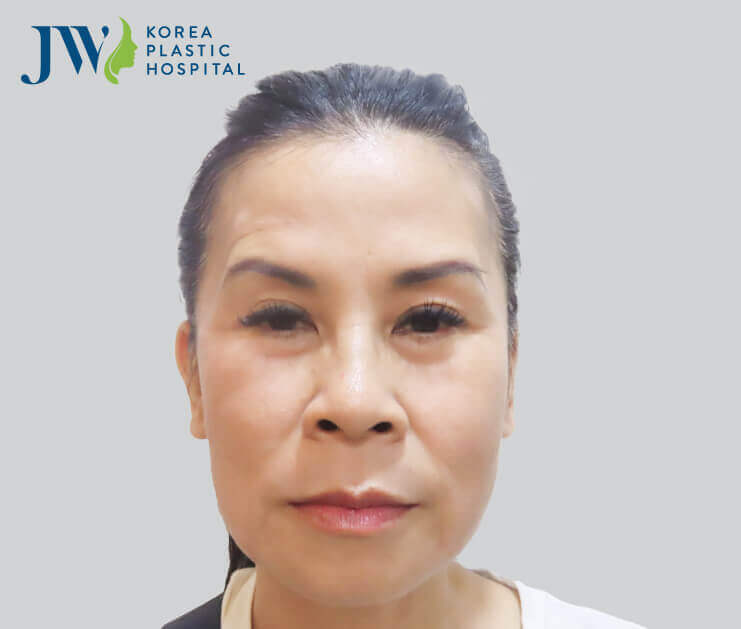 anh chinh dien