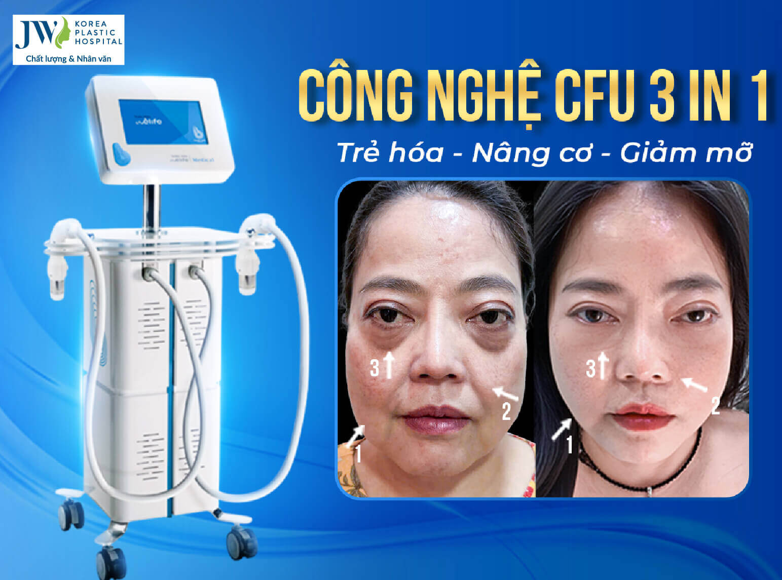 cfu-3-in-1