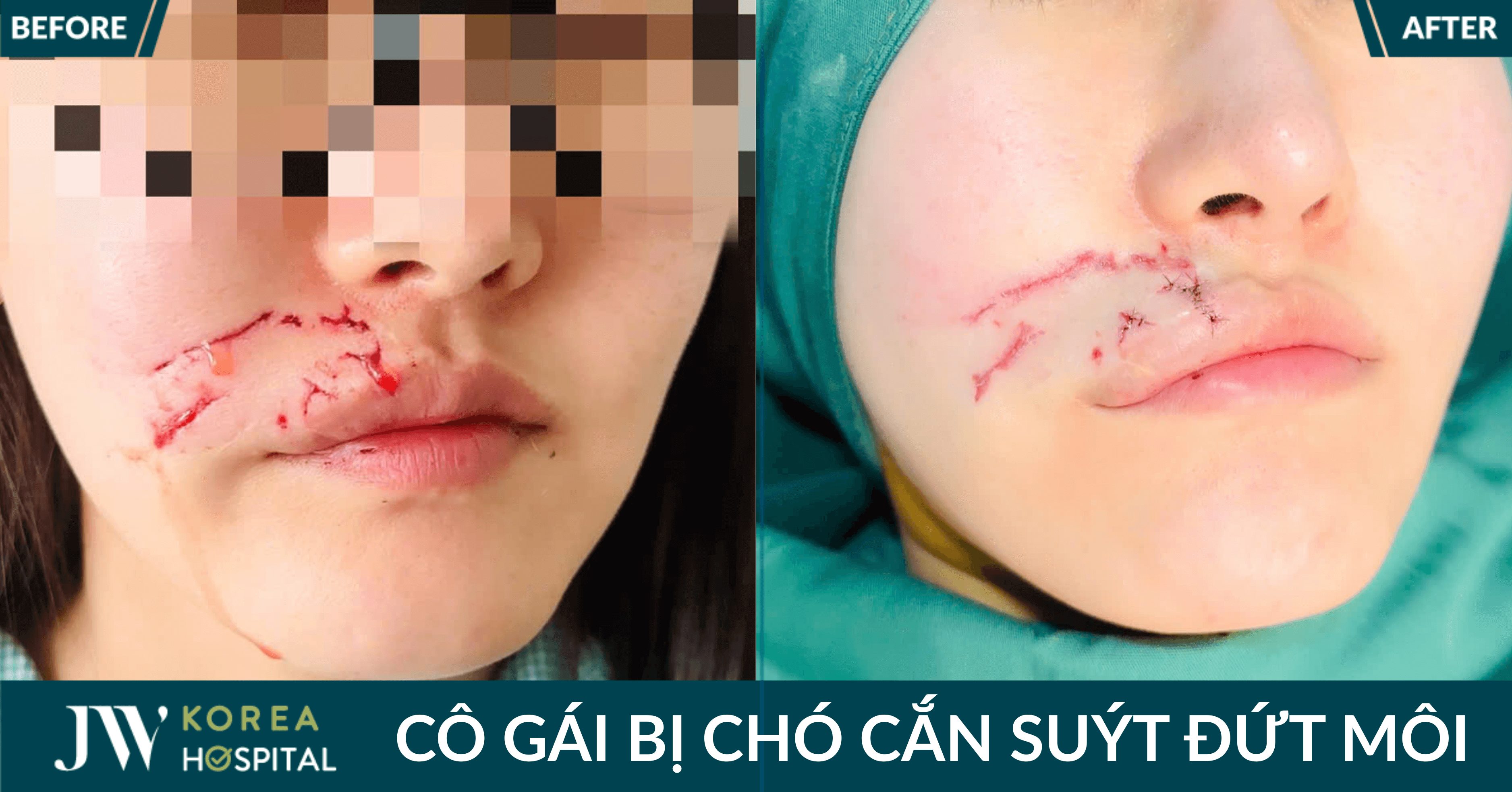 co gai bi cho can dut moi