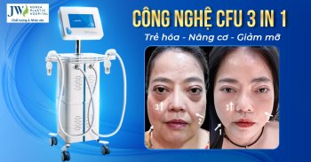 Nâng cơ – xóa nhăn – giảm mỡ với công nghệ CFU 3 IN  1 vượt trội tại JW