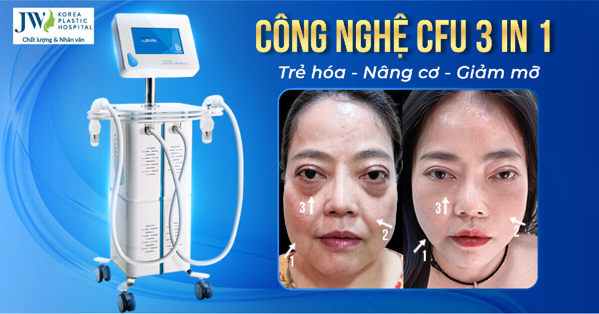 cong nghe cfu 3 in 1