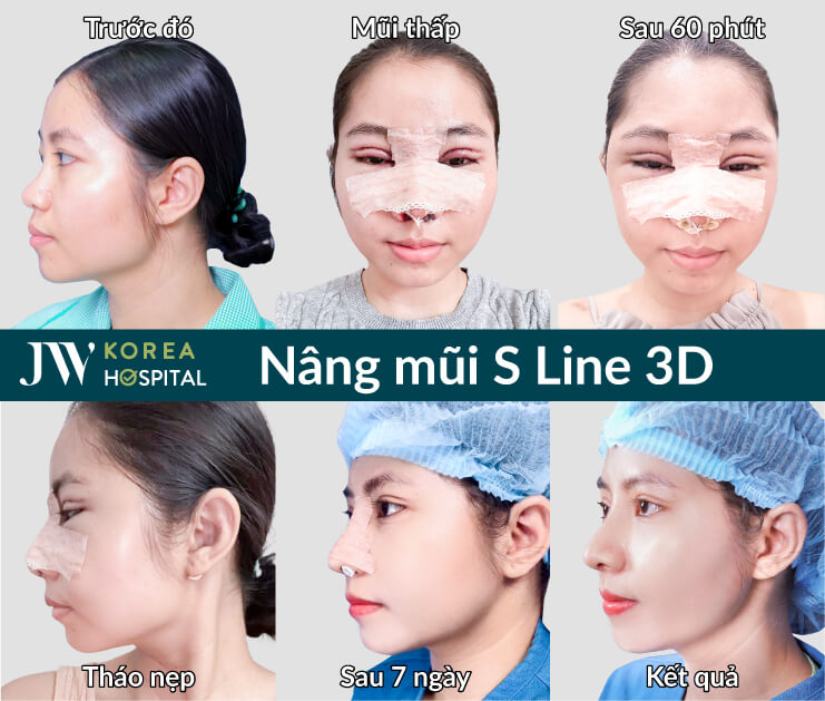 nang mui s line 3d tai jw tinh ca nhan hoa cao