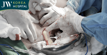 bien chung tiem filler