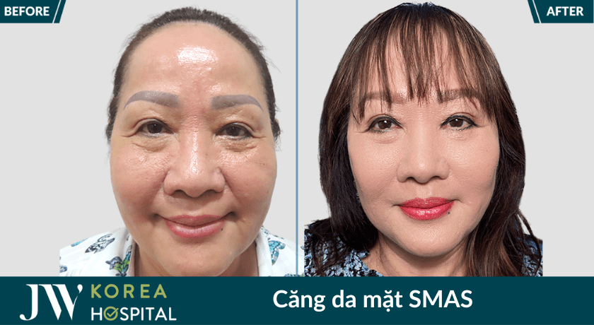 cang da mat