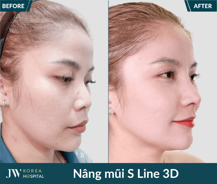 nang mui s line 3d 259x220