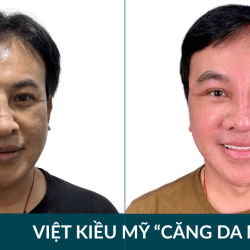 Việt kiều Mỹ trẻ 20 tuổi sau căng da mặt tại JW, mua 200 cuốn sách nuôi trẻ em nghèo