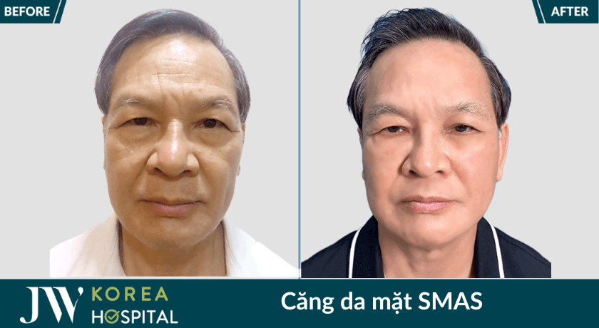 cang da mat 1