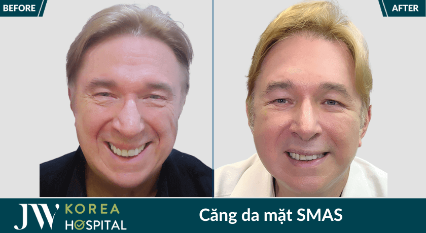 cang da mat 3