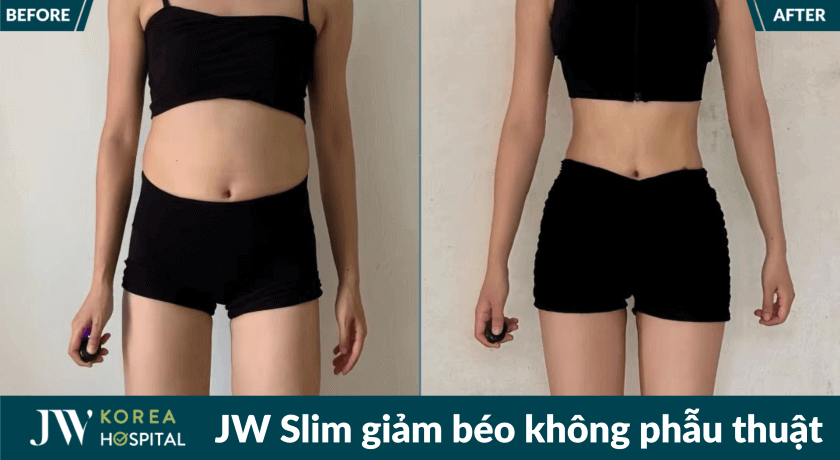 jw slim 20