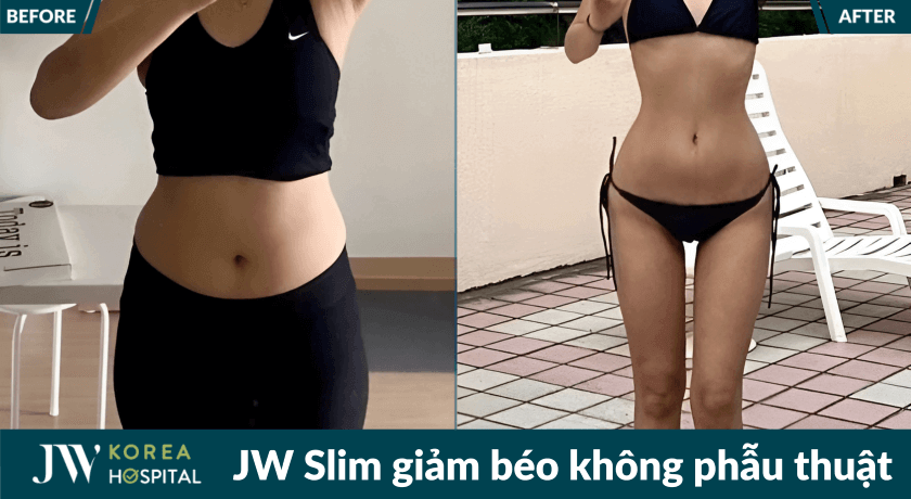 jw slim 21