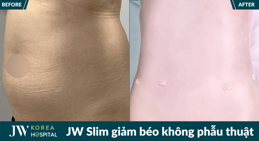 jw slim 22