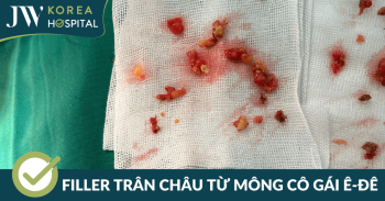 Tiêm filler giả: Cô gái Ê-đê trả giá đắt với hàng chục filler trân châu ở mông phải cầu cứu bác sĩ JW