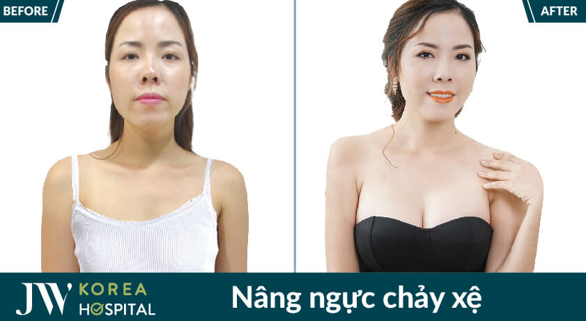 nang nguc chay xe