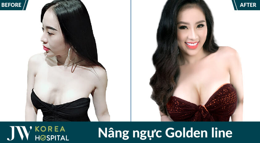 Nang nguc Golden line