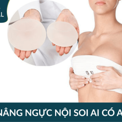 Nâng ngực nội soi AI có thật sự an toàn? Giải pháp hiện đại cho phái đẹp