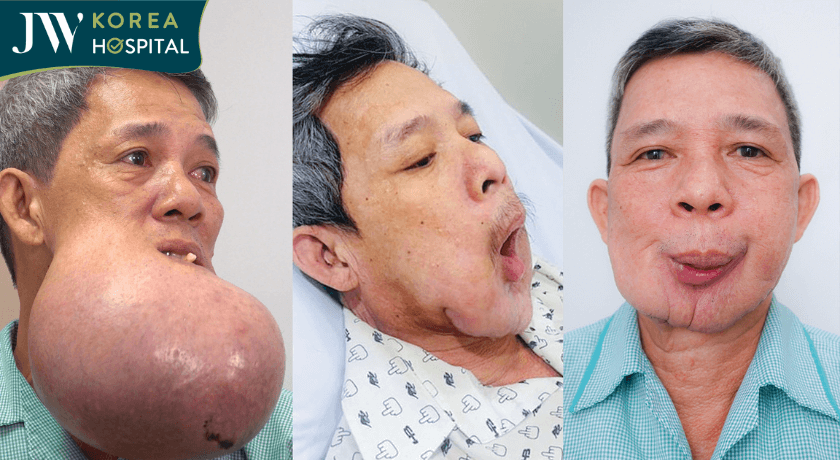 sự thay đổi chú khanh sau quá trinh phẫu thuật