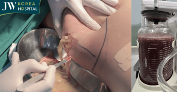 bien chung tiem filler mong