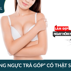 Nâng ngực trả góp có thật sự an toàn? Lựa chọn đúng đắn khi làm tại Bệnh viện JW