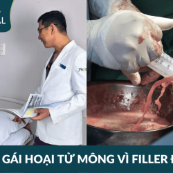 Bác sĩ Tú Dung Bệnh viện JW hồi sinh 2 cô gái trẻ bị hoại tử mông vì tiêm filler giả