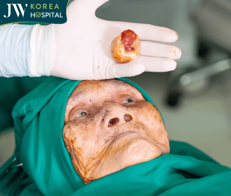 bác sĩ tú dung mổ khối u thành công cho cụ bà 100 tuổi