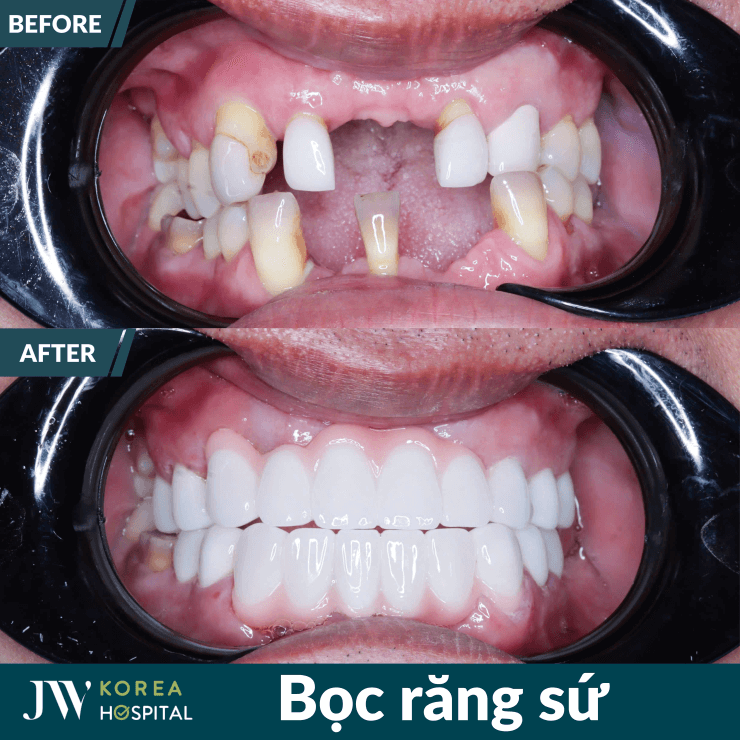 boc rang su chuan han jw