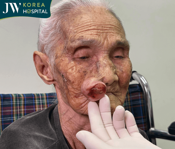 cụ bà 100 tuổi gặp thăm khám cùng bác sĩ Tú Dung