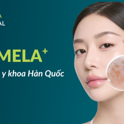 Trị nám JW MELA+ Giải pháp chuẩn y khoa giúp cải thiện nám, dưỡng sáng da