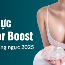 Túi ngực Mentor Boost – Kỷ nguyên mới của công nghệ nâng ngực 2025 tại JW