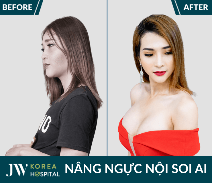 nang nguc noi soi ai tai jw giup khach hang so huu vong 1 cang tron, quyen ru