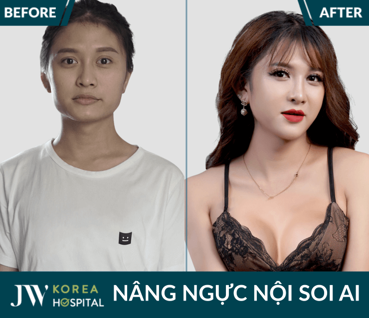 nang nguc noi soi ai tai jw duoc nhieu khach hang tin chon