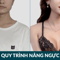 Quy trình nâng ngực nội soi AI chuẩn Hàn tại JW – Bí quyết an toàn để sở hữu vòng 1 quyến rũ