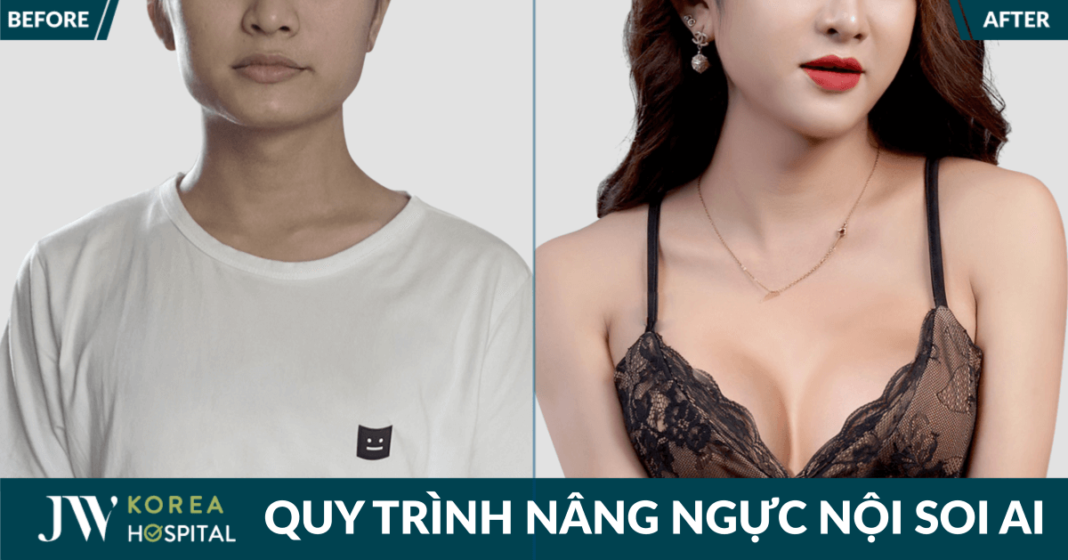 quy trinh nang nguc noi soi ai an toan tai benh vien jw han quoc
