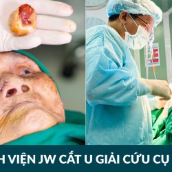 Cụ bà 100 tuổi phẫu thuật thẩm mỹ không để đẹp, mà để thở bình thường