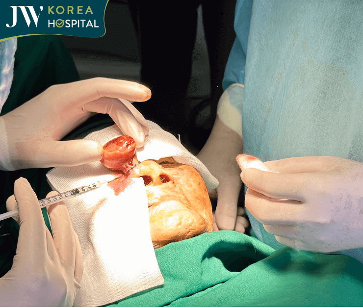 tiến hành phẫu thuật cắt khối u