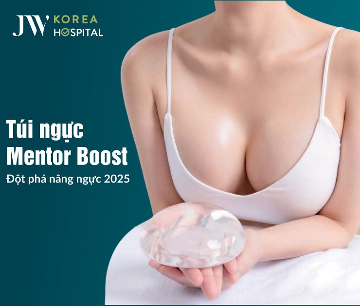 túi ngực mentor boost