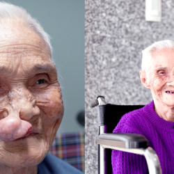 Cụ bà 100 tuổi hồi phục kỳ diệu sau ca mổ u mạch máu tại Bệnh viện JW