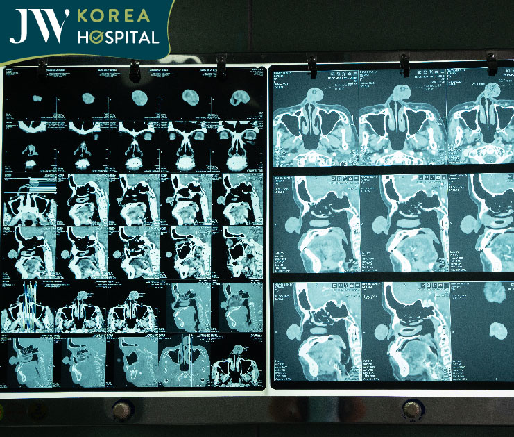 Hình chụp MRI của sư bà khơ-me