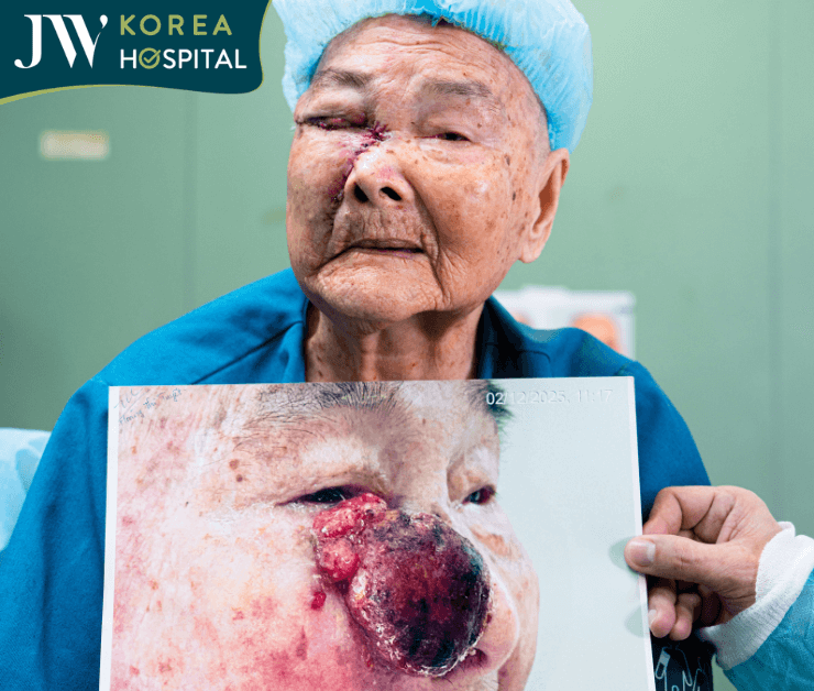 bac si jw cat u mat cho cu ba