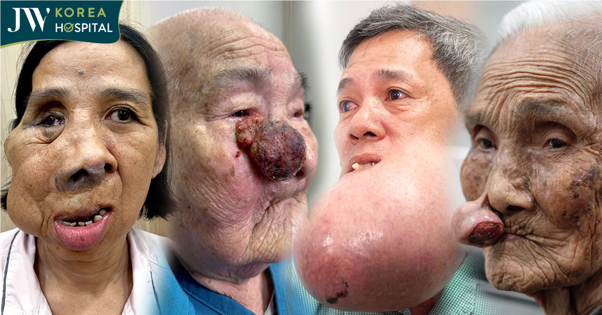 Bệnh viện JW hơn 10 năm phẫu thuật thiện nguyện cho bệnh nhân nghèo