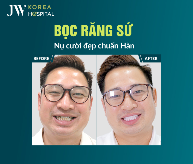 Bọc răng sứ tại bệnh viện JW được thực hiện trong môi trường vô trùng, an toàn, đạt chuẩn y khoa