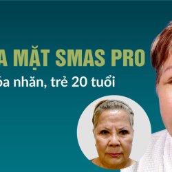 Căng da mặt SMAS Pro tại JW – Trẻ hóa toàn diện, giữ nét tự nhiên